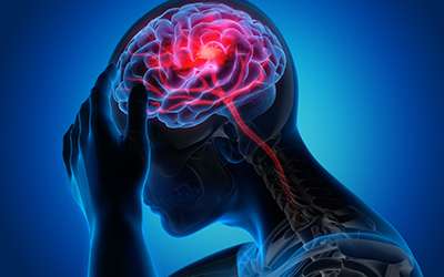 Epilepsia e Convulsão são a mesma coisa?
